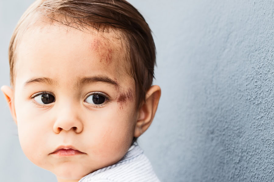 Bebé herido por mal funcionamiento del producto