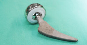 Hip Replacement